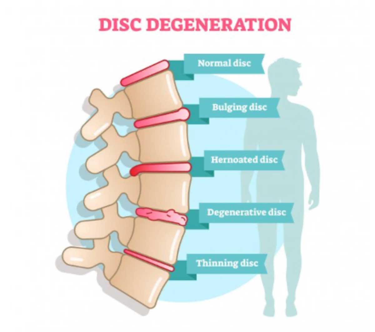 cbd for back pain