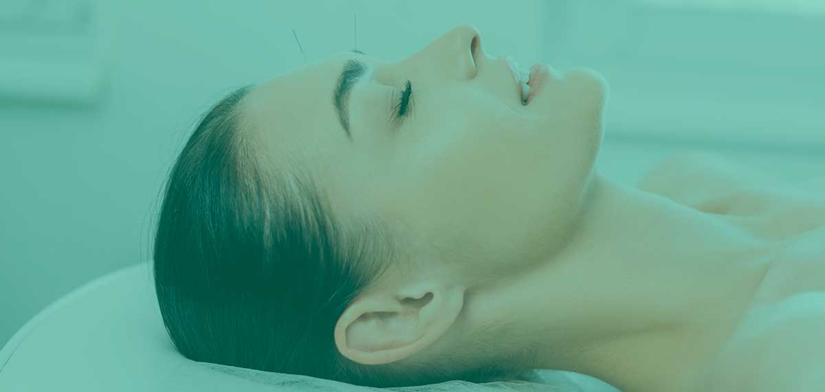 acupuncture au cbd