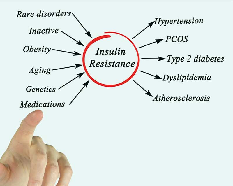 aterosclerosi causes