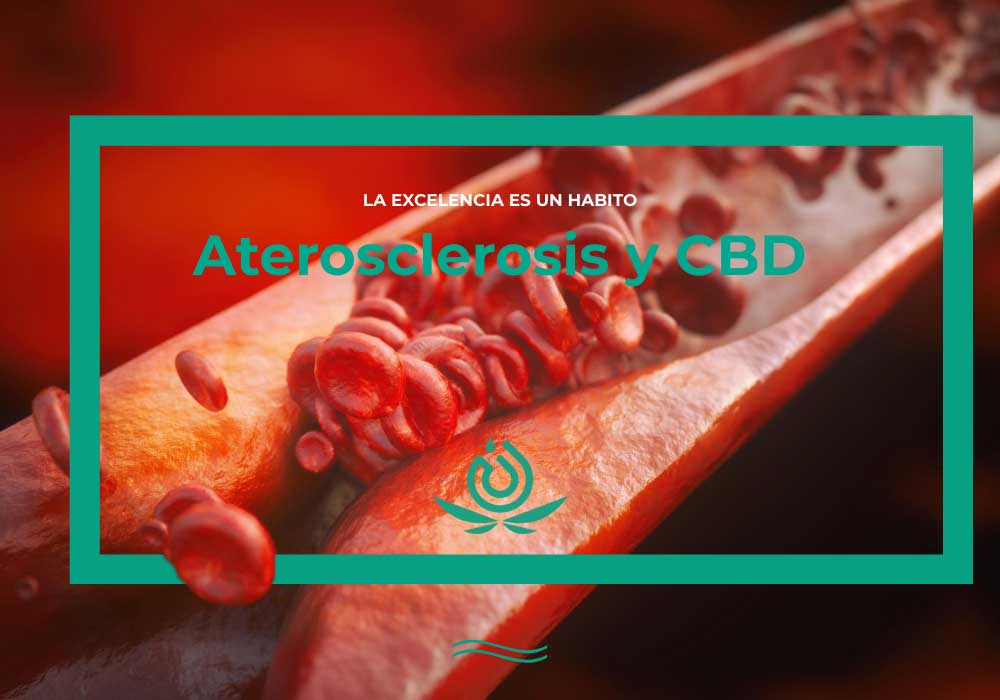 atherosclerosis and CBD